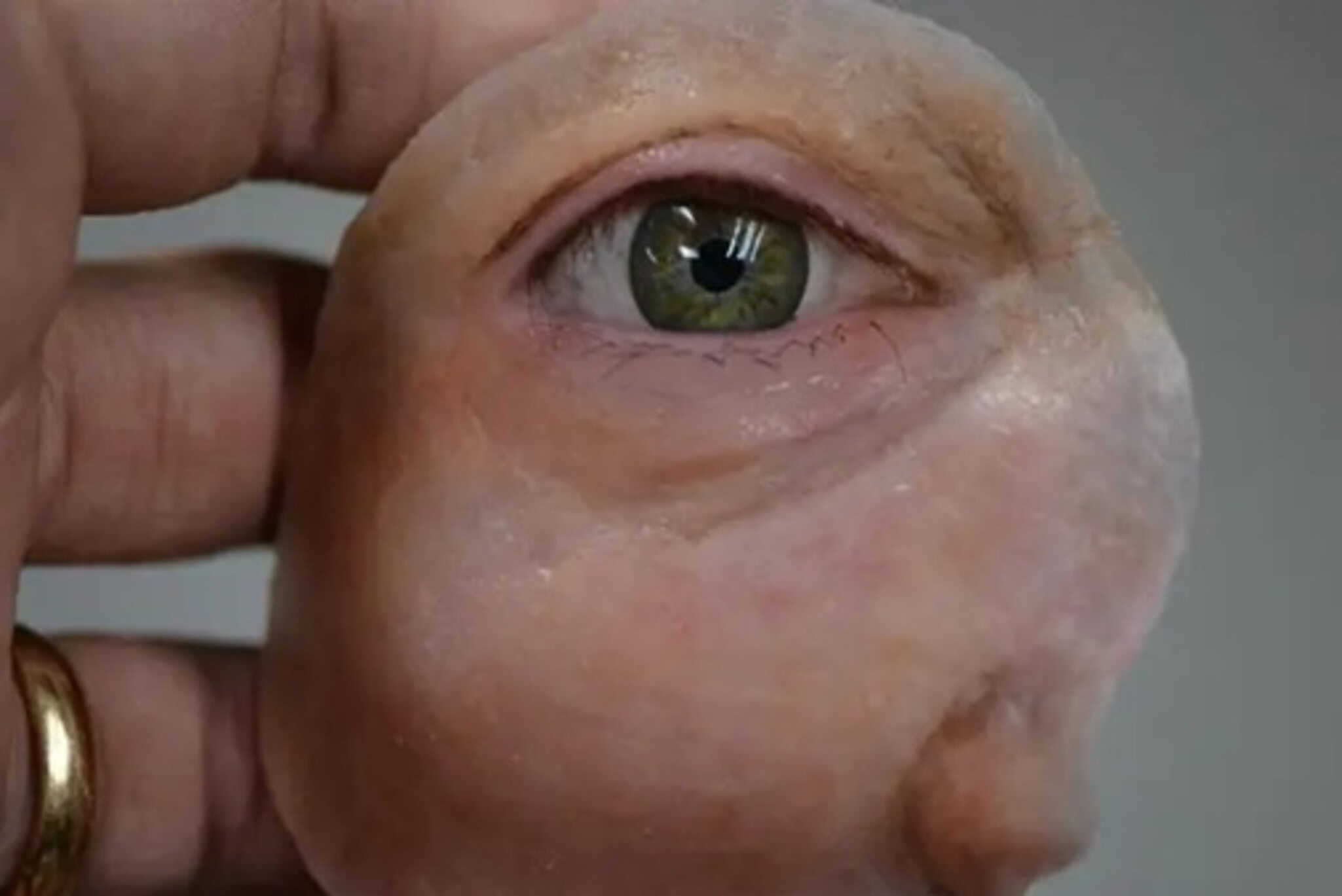 Impressão 3D viabiliza próteses faciais gratuitas para vítimas de câncer de cabeça e pescoço - Imagem do artigo