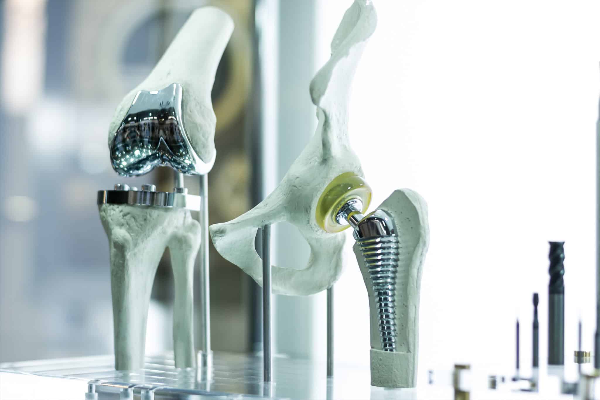 Metal líquido em implantes ortopédicos mostra ação antimicrobiana e acelera recuperação óssea, aponta estudo - Imagem do artigo
