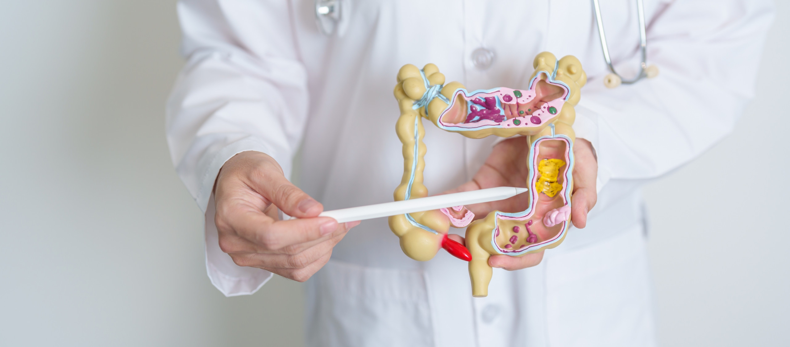 Inteligência artificial ajuda UC San Diego a esclarecer papel do gene NOD2 na doença de Crohn - Imagem do artigo