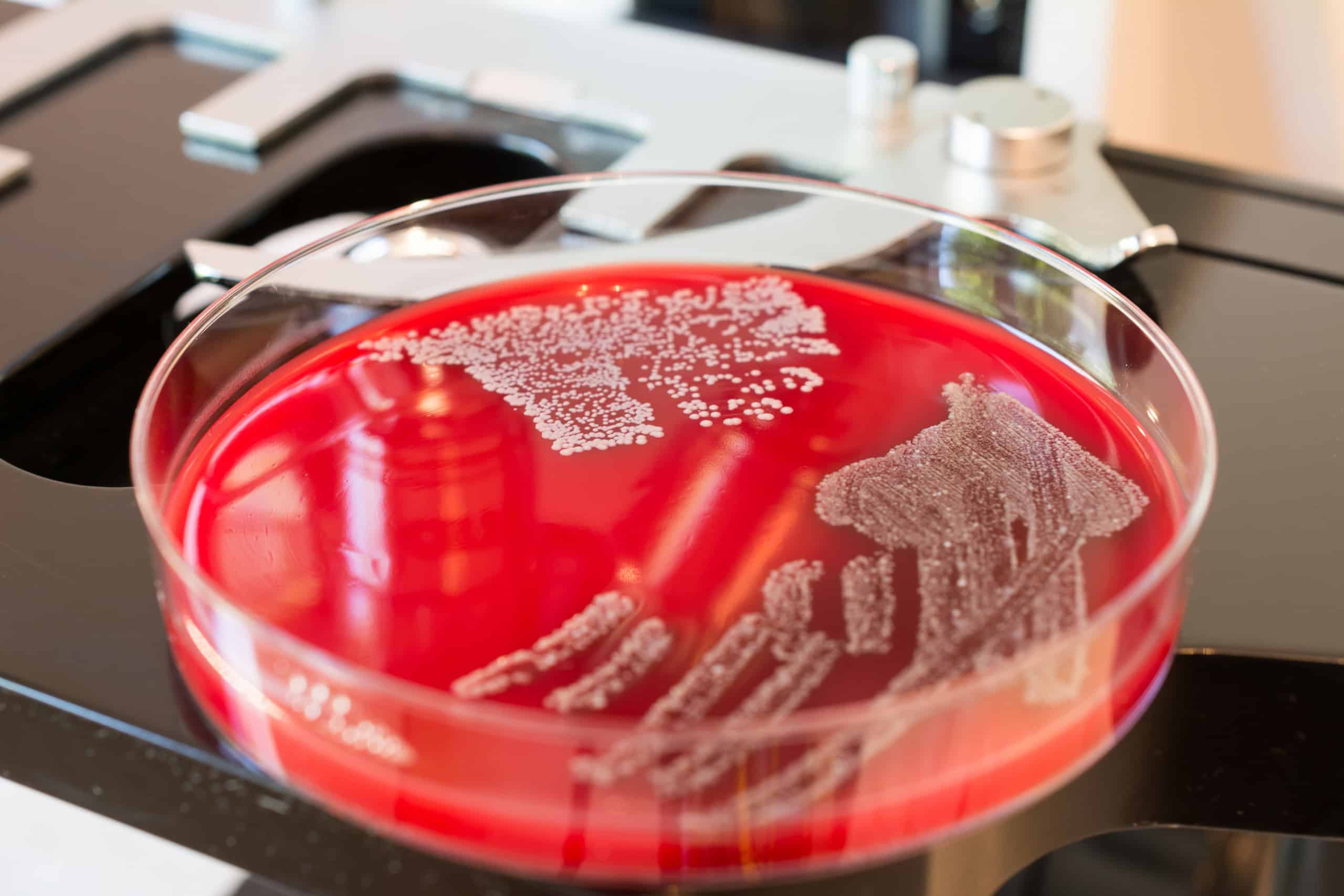 Enzima brasileira desmonta biofilme de superbactéria e reforça ação de antibióticos - Imagem do artigo