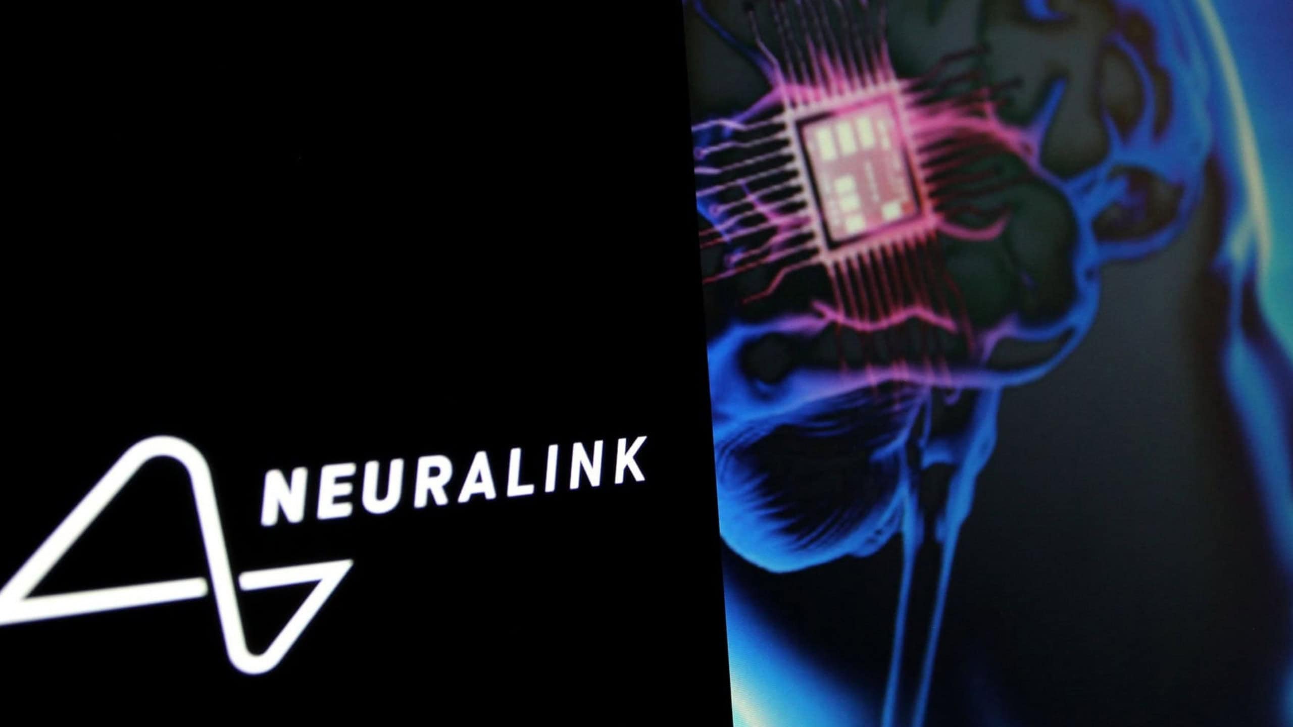 Neuralink planeja produção em larga escala de chips cerebrais e cirurgias automatizadas até 2026 - Imagem do artigo